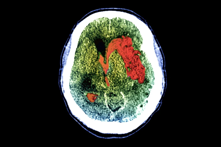 Neuroimaging 