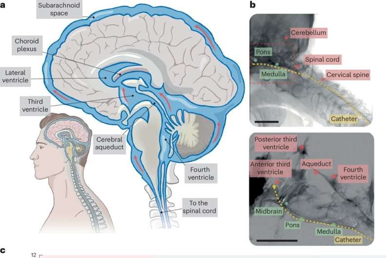 interfaccia neurale