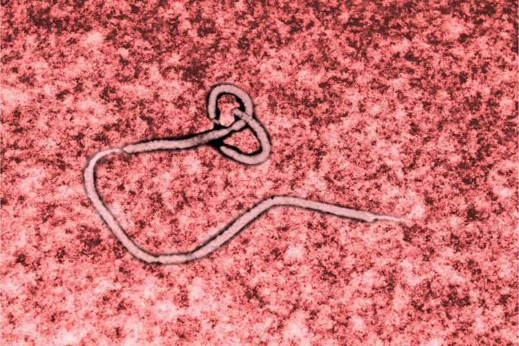 La pillola che cura l’ebola: risultati straordinari nei test su animali