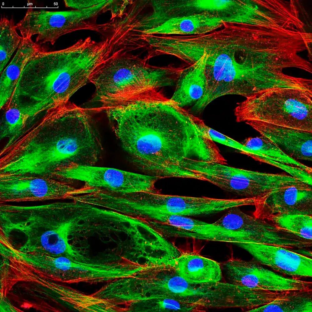 Neuroni dalla pelle: il futuro delle lesioni spinali? Le cellule cutanee